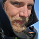 Martin Klaesson